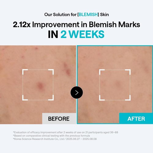 MEDIHEAL Toner Pads - Madecassoside Blemish Care with Centella Asiatica - 100 Count for Even Skin Tone & Deep Hydration