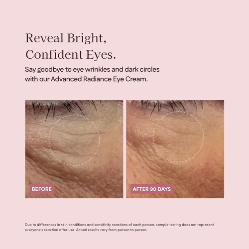 Pretti5 Advanced Radiance Eye Cream - Reduces Puffiness & Dark Circles | Vegan & Sensitive Skin Safe, 12g