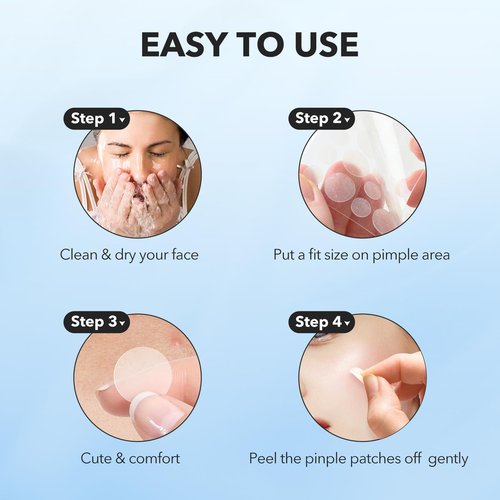 QUSTERE Pimple Patches for Face, Hydrocolloid Acne Patches, Cute Round Shape Zit Covers, Spot Stickers with Tea Tree, Salicylic Acid & Cica Oil| 2 Sizes (9mm, 12mm) |288 Count