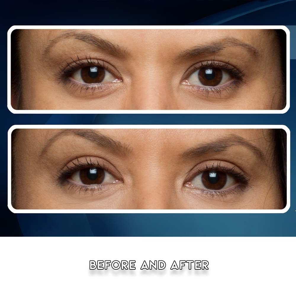 Eye Magic Combo Pack: 128 Eyelid Lift Strips - 64 Regular & 64 Large Sizes | Non-Surgical Eyelid Lift Solution for Natural Looking, Youthful Eyes