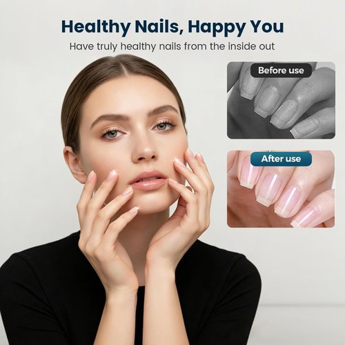 3 Days Nail Care Oil, 2026 Upgraded Keratin Nail Strengthener, Nail Repair Intensive, Nail Moisturizer Gloss for Brittle Nails, for Women (1pcs)