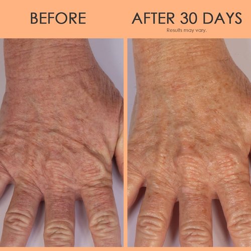 **Crepe Erase Hand Repair Treatment - Anti-Aging Lotion with Shea Butter & Vitamin E | 3 fl oz**