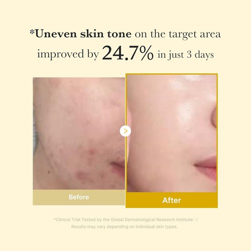 Medicube Kojic Acid Turmeric Peel-Off Mask - Brightens & Defends Skin Stress | 2.53 fl. oz.