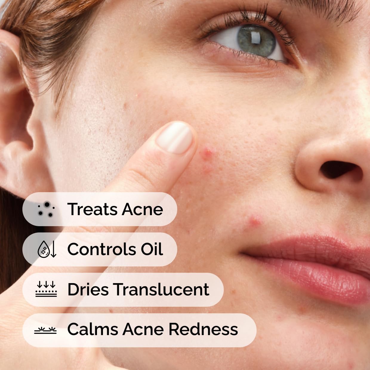 The Ordinary Sulfur 10% Acne Spot Treatment - Reduces Pimple Size & Redness | 0.18 Oz