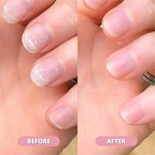 Anperio Stem Cell Nail Growth Pen, Anperio Nail Growth Pen, Anperio Nail Serum Pen, New Nail Growth Oil Pen, For Moisturize Strengthen Nail, Cuticle Oil for Nails Strengthener-Strawberry