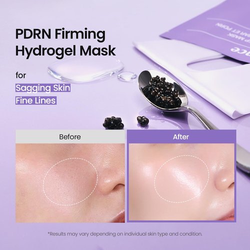 BIODANCE Rejuvenating Caviar PDRN Real Deep Mask, Overnight Hydrogel Face Mask, Skin Firming, Radiance, Enhancing Skin Recovery, Korean Skin Care | 1.19oz(34g) x 4ea