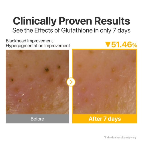 Numbuzin No.5 Cleansing Oil - Glutathione & Vitamin C Formula for Pores & Dark Spots | 6.76 fl oz