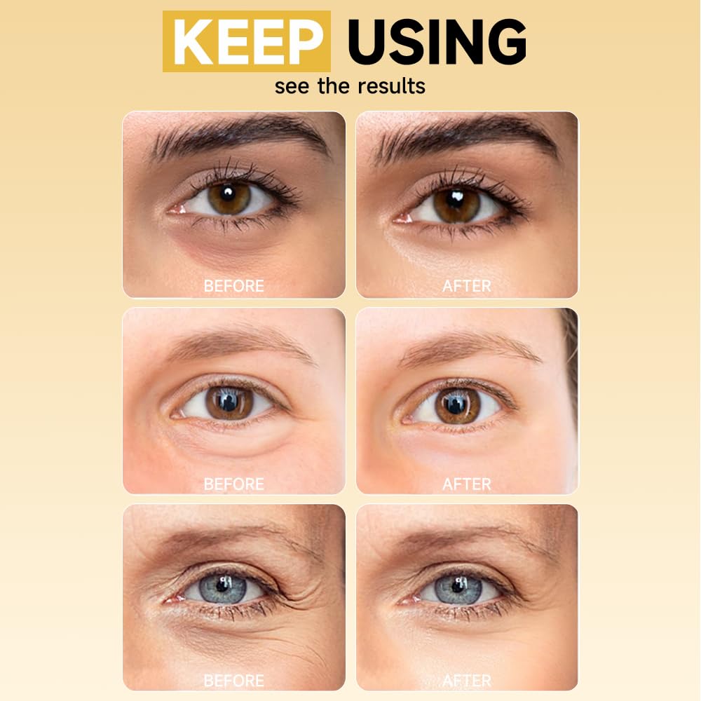 Skiennix 5% PDRN Under Eye Patches - 6-in-1 Bio-Collagen for Puffy Eyes & Dark Circles | 8 Pairs
