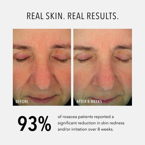 Hydropeptide Soothing Serum - Moisturizing Anti-Aging Facial Serum | 1 Ounce