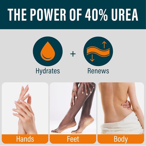 NUVADERMIS 40% Urea Cream - Maximum Strength Moisturizer for Extremely Dry Skin - 5.3 fl oz
