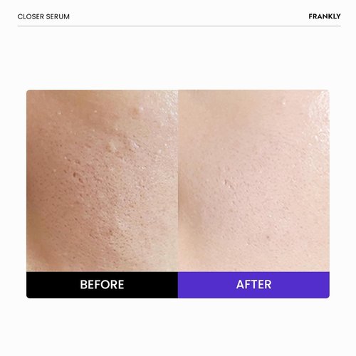 FRANKLY Closer Serum - Pore Minimizer with 9 Peptides & Vegan Collagen | Korean Anti-Aging Hydration | 1.01 fl oz