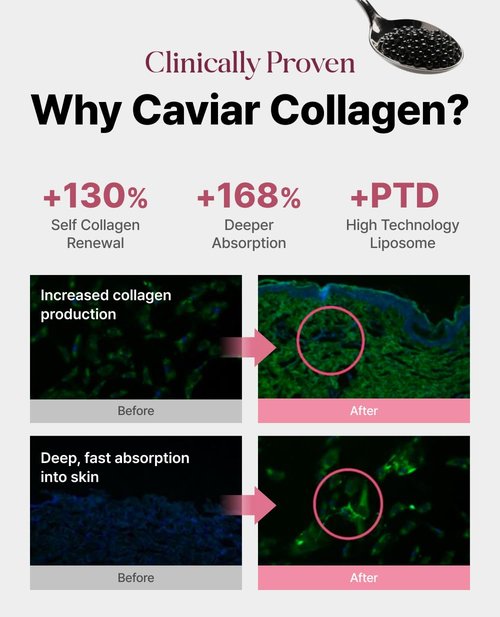 Delere Caviar Glow Smoothing Serum - Caviar Collagen with Niacinamide & Retinol for Radiant Skin | 1.7oz