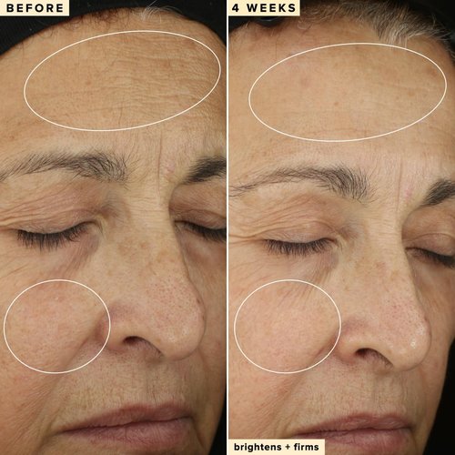 Farmacy 10% Vitamin C Serum for Face - Brightening Vitamin C Face Serum to Firm + Smooth Skin Texture - L Ascorbic Acid + Tangerine Peel Infused Skin Care to Hydrate and Even Skin Tone (30ml)