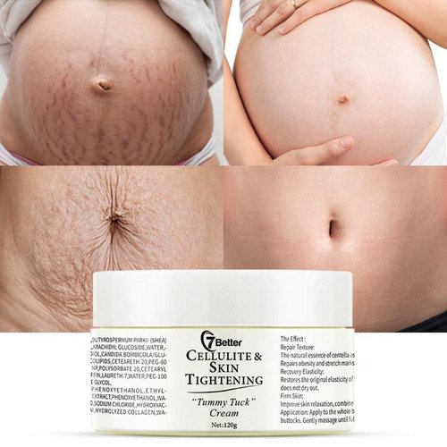 Regine Switzerland Stretch Marks & Scars Removal Cream - Firming & Repair for Pregnancy Skin