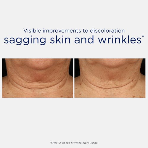 NEOSTRATA Triple Firming Neck Cream - Rejuvenate Décolletage with MicroDiPeptide229® & Bakuchiol | 80g, Fragrance-Free
