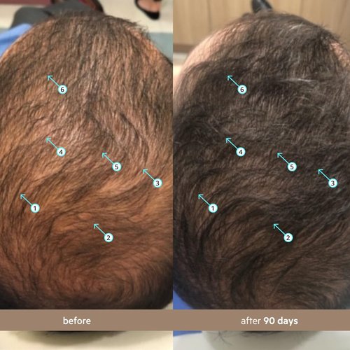 DS Labs Spectral Hair Density Serum - Lightweight Leave-In for Fuller, Thicker Hair | 60mL, All Hair Types