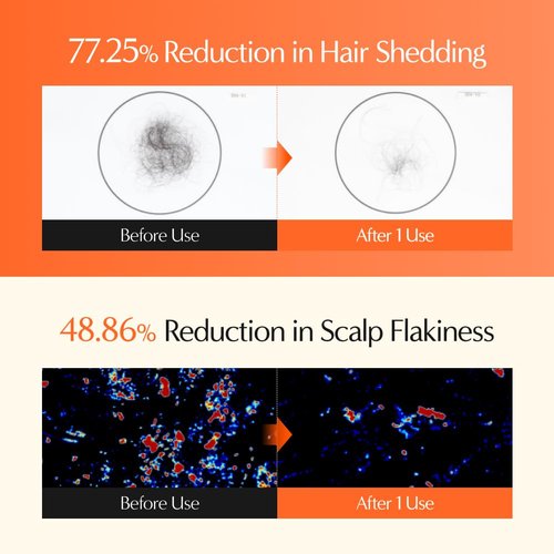 lilyeve GrowTurn 3D Volume Shampoo with Built-in Brush – For Thinning Hair & Fuller-Looking Volume, Hair loss, Gentle Scalp Care | 6.76 Fl Oz