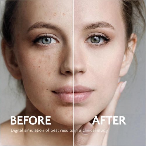 Regine Switzerland Hydraquinon0l Dark Spot Brightening Cream - 4% Non-Irritating Formula for All Skin Types, 1oz