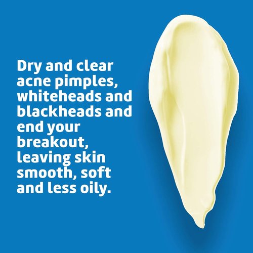 De La Cruz Sulfur Ointment - Effective Cystic Acne Treatment for Face & Body - 2.6 OZ Tube, 2-Pack
