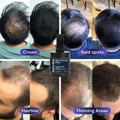 Hair Density Filler (10g/0.35oz) - Instant Gray Coverage & Bald Spot Concealer, 24-Hour Waterproof Stain-Proof Hair Powder Root Touch Up for Women & Men, Daily Use & Events (Black*1)