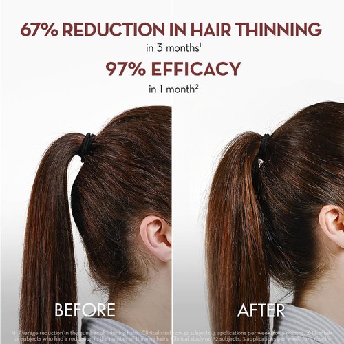 Klorane Intense Strengthening Serum with Quinine - Natural Hair Thinning Solution for Thicker, Stronger Hair - 3.3 fl. oz.