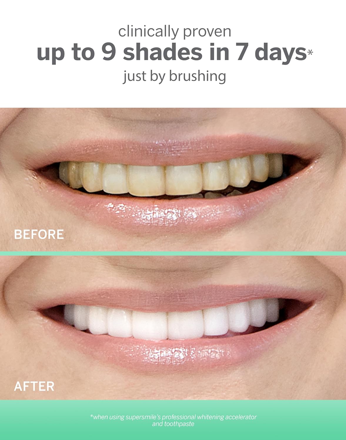 Supersmile Professional Whitening Accelerator - Fast-Acting Teeth Whitener | 7 Ounce