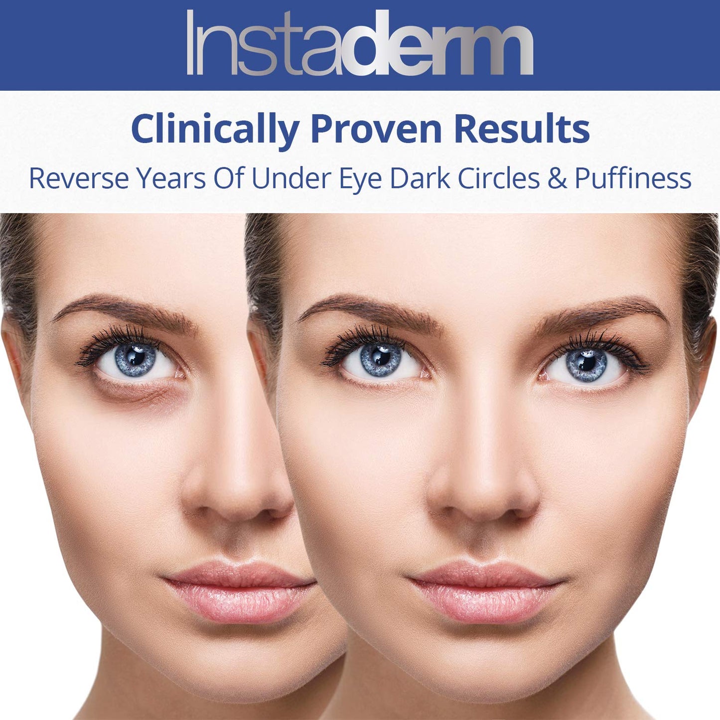 Instaderm Vitamin K Cream- Bruise Healing Formula with Arnica. Dark Spot Moisturizer for Bruising, Spider Veins & Broken Capillaries. Repair Under Eye Dark Circles, & Puffiness.
