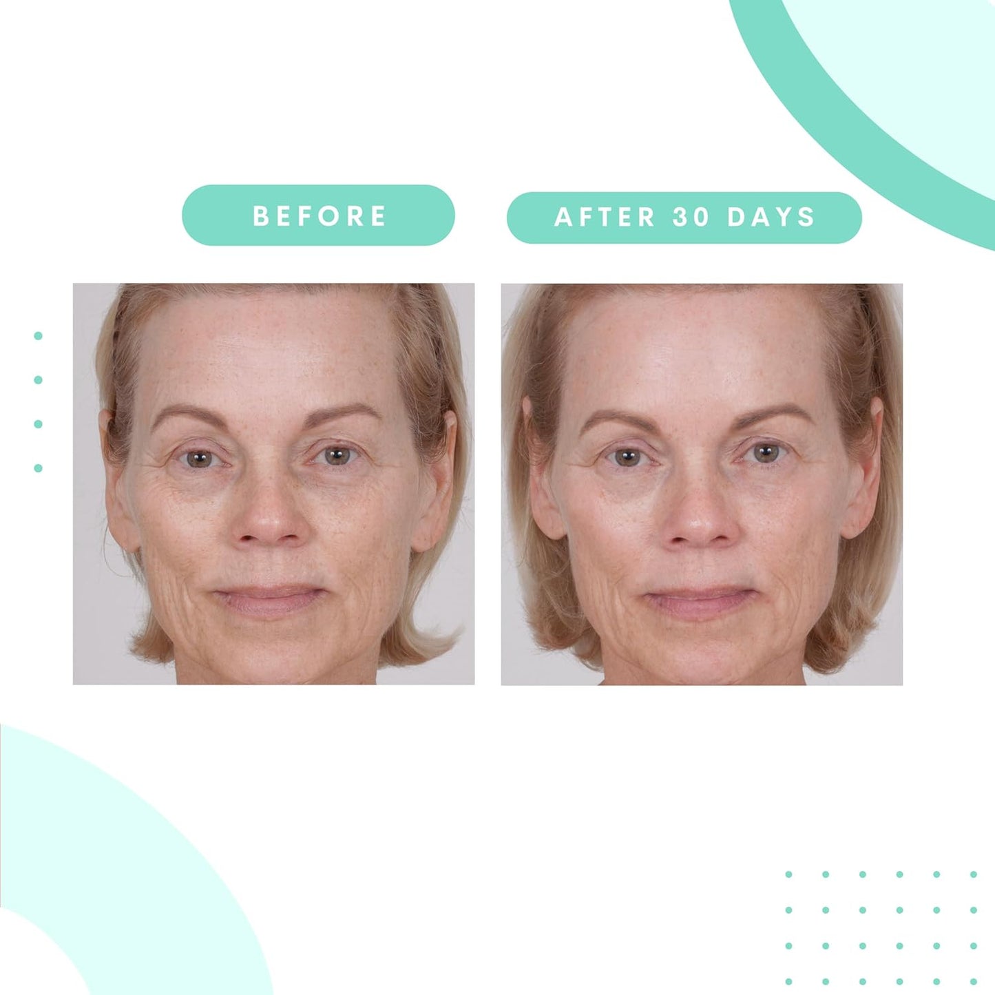 Serious Skincare Glycolic Acid Treatment Pads - Exfoliating Face Discs for Fine Lines & Wrinkles | 2 Pack (60 Pads Each)