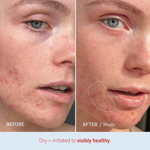 First Aid Beauty Ultra Repair Cream – Scented Variants