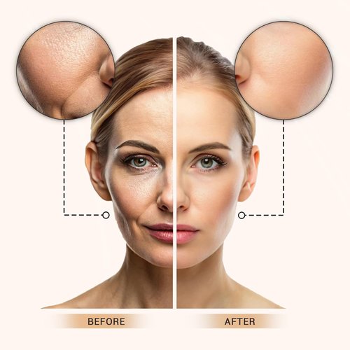 Lx Blend Bye Bye Foundation - Oil-Free Matte Coverage Moisturizer with SPF 50 | Medium, 1 Fl Oz