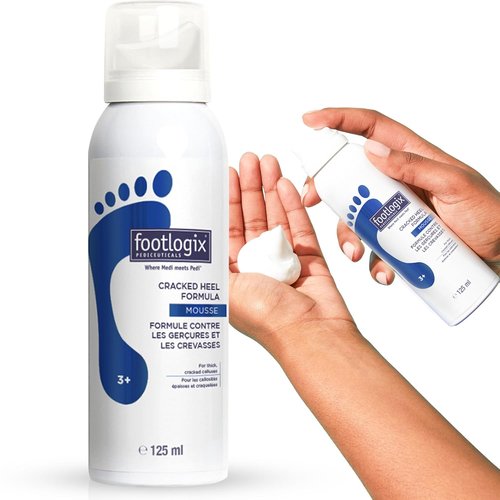 Footlogix Cracked Heel Formula - Repair Dry, Cracked Skin | 4.23 Ounce White Cream