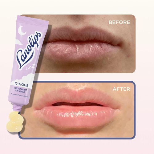 Lanolips 12 Hour Overnight Lip Mask - Hydrating Lip Balm with Hyaluronic Acid & Vitamin C - Restore & Soften While You Sleep - Cruelty-Free (0.52 oz / 15 g)