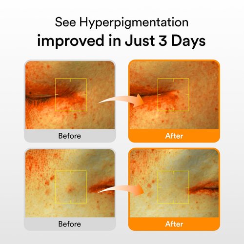 Abib Glutathiosome Dark Spot Serum - 1.69 fl. oz. | Korean Skincare for Hyperpigmentation & Sensitive Skin