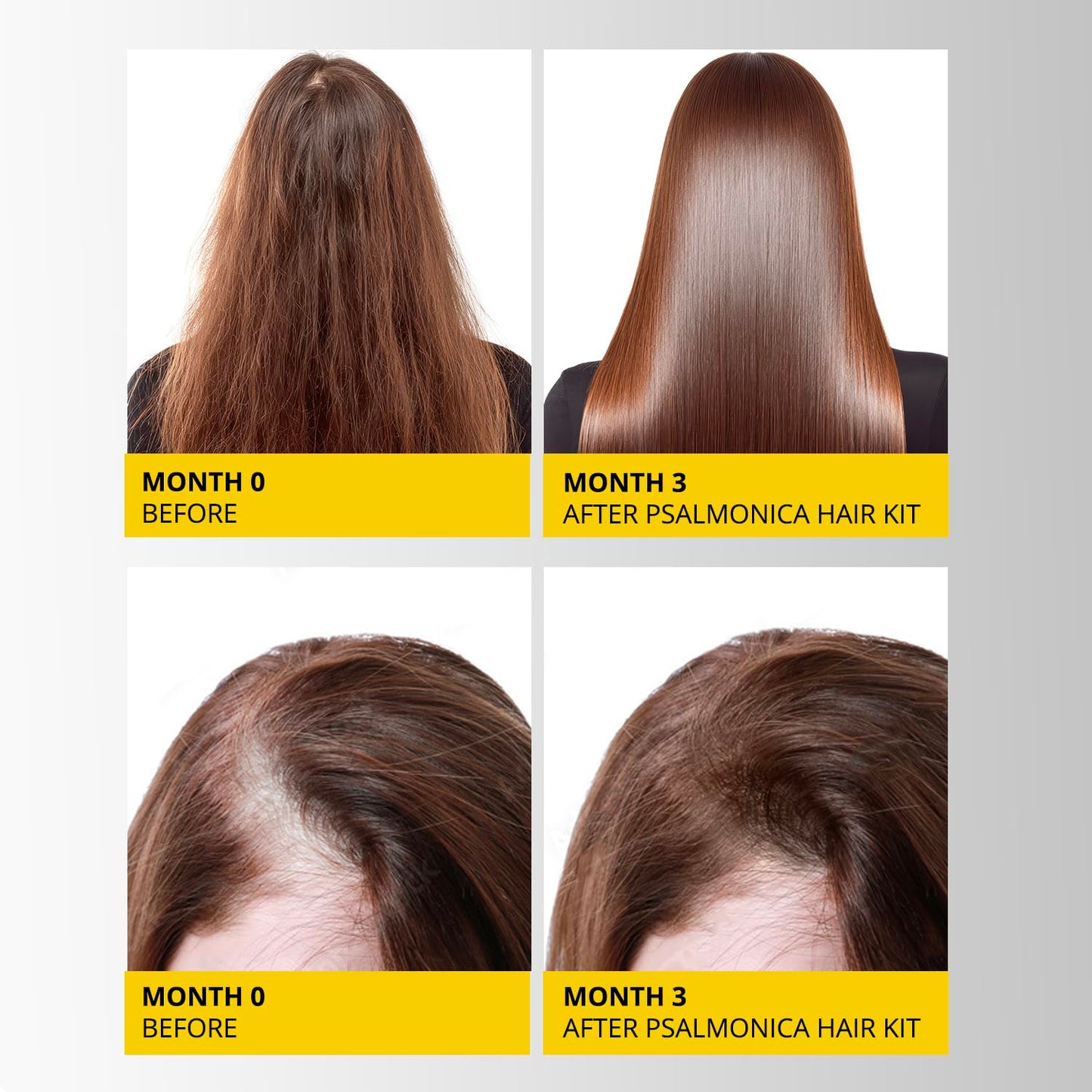 Skiennix Hair Growth Shampoo & Conditioner Set - Sulfate-Free Thickening Formula for Hair Loss & Thinning Hair