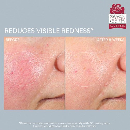 RescueMD DNA Repair Complex PRO Scar Treatment Serum - Skin Damage Solution, 120ml