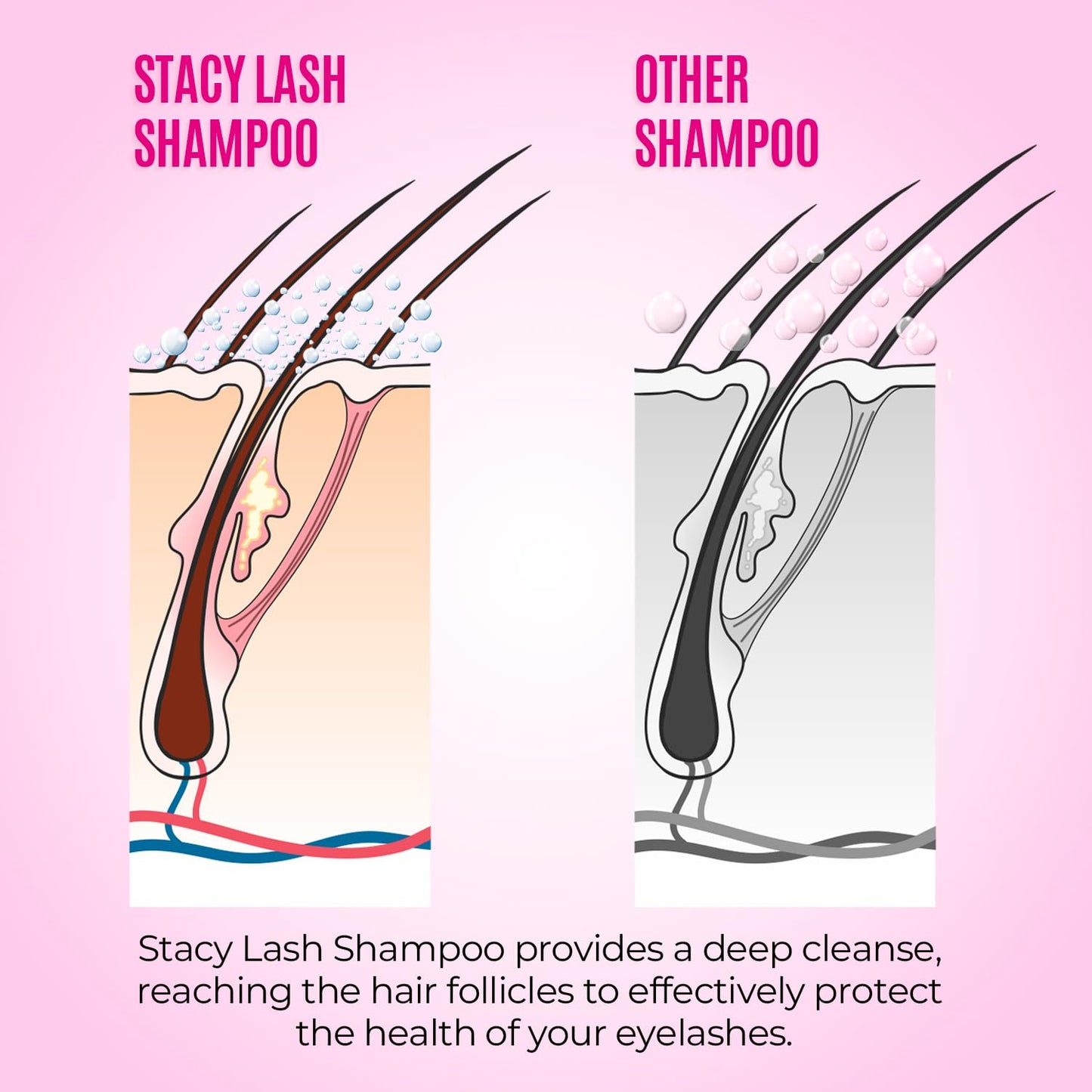 Stacy Lash Foaming Lash Shampoo Kit - 50ml Cleanser with Spoolies, Rinse Bottle & Brush for Extensions
