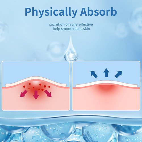 Daolyo Pimple Patches for Face, 4 Size 360 Counts Hydrocolloid Acne Patches for Covering Zits and Blemishes, Spot Stickers with Salicylic Acid, Tea Tree Oil & Calendula Oil, Mini Package
