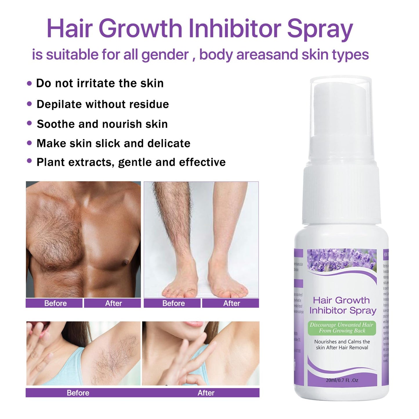 Hair Growth Inhibitor for Face, Hair Inhibitor Permanent Spray, Non-Irritating Hair Inhibitor, Permanent Hair Removal Spray for Body, Face, Underarm, Arm, Leg, Private Areas, Slows Regrowth (1)