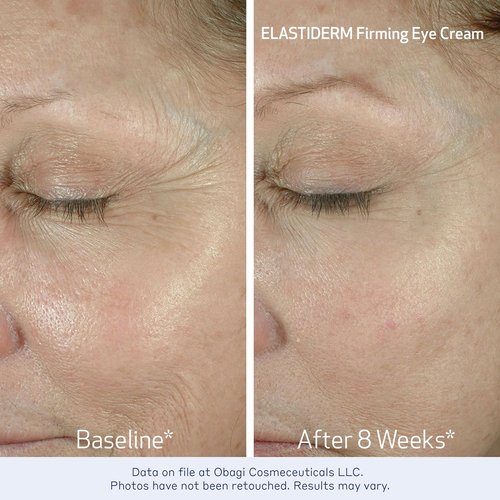 Obagi ELASTIDERM Lift Up & Sculpt Facial Moisturizer & Eye Cream Set - Anti-Aging Formula 1.7oz & 0.5oz