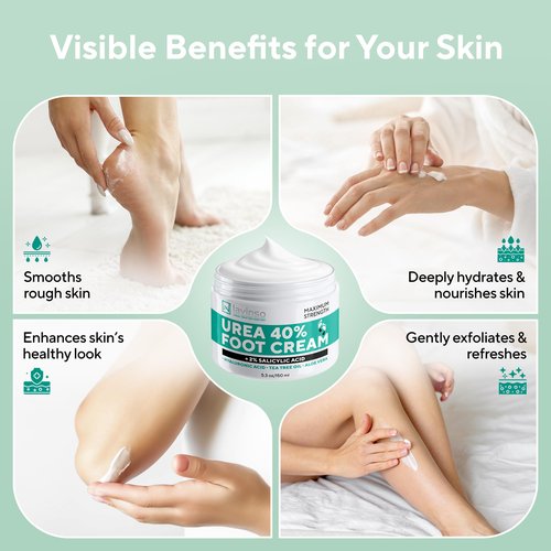 Lavinso Urea Cream 40 Percent for Feet with Maximum Strength - Foot Cream for Calluses and Dry Cracked Heels - Rough Skin Repair for Men and Women