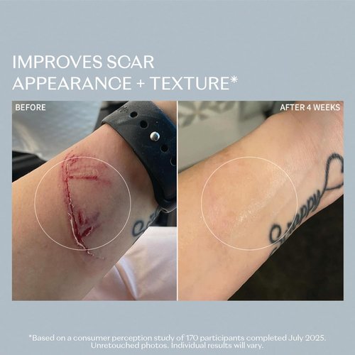 RescueMD DNA Repair Complex PRO Scar Treatment Serum - Skin Damage Solution, 120ml