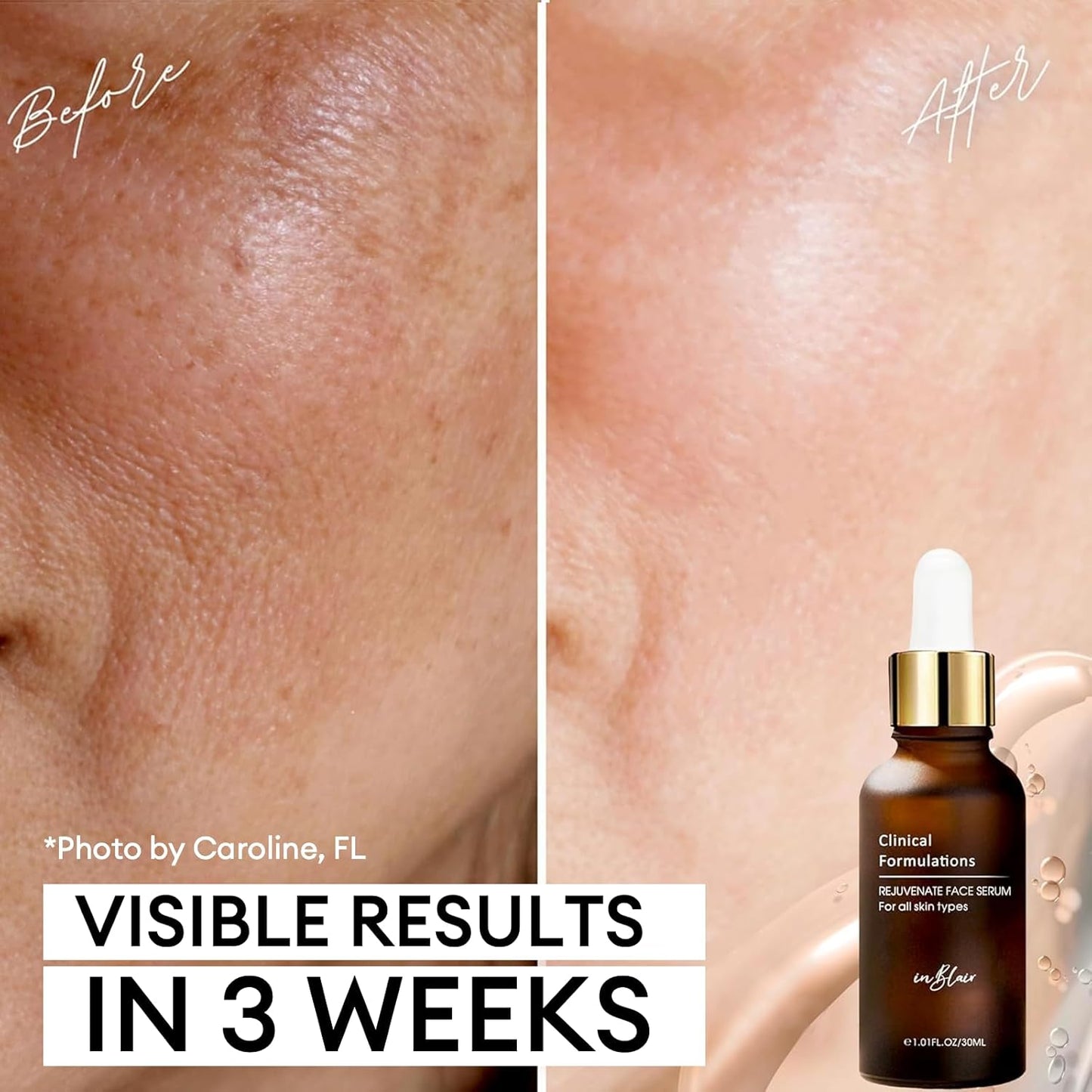 Rejuvenate Resurfacing Face Serum - Anti-Aging Formula for Wrinkles, Fine Lines & Dark Spots - 1 fl. oz.