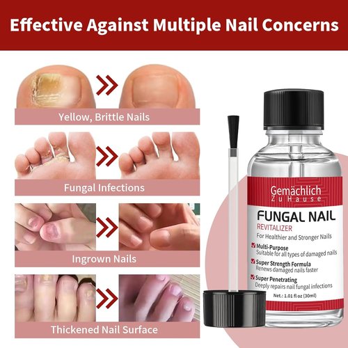 Regine Switzerland Toenail Fungus Treatment - Extra Strength Antifungal Nail Repair with Undecylenic Acid | 30ml