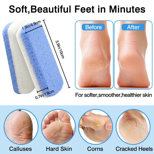 Durable Callus Remover & Dual-Sided Foot Scrubber for Exfoliation and Pedicure ，2-Pack Glass Pumice Stones