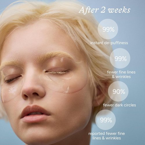 In My Eyes Hydrating Under Eye Patches - Hyaluronic Acid Hydrogel Masks for Dark Circles & Puffiness | 5 Pairs