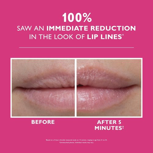 Peter Thomas Roth | Instant FIRMx® Lip Filler - Plumping Treatment for Enhanced Volume & Smooth Lip Lines