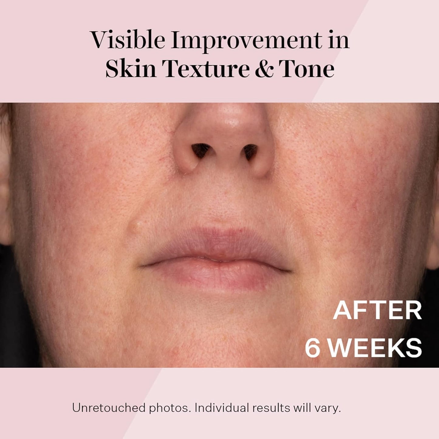 StriVectin Advanced Retinol | Targets Visible Signs of Aging for Healthier, Youthful Skin