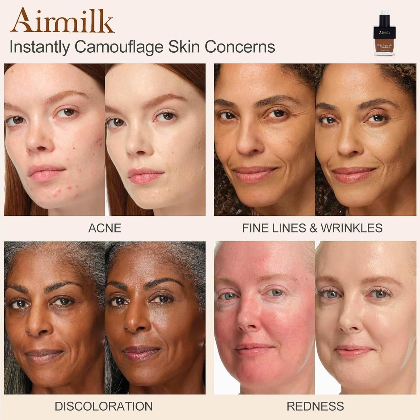 Skiennix Full Coverage Foundation - Skincare Makeup with Salicylic Acid for Sensitive Skin | 30ml Deep Cool