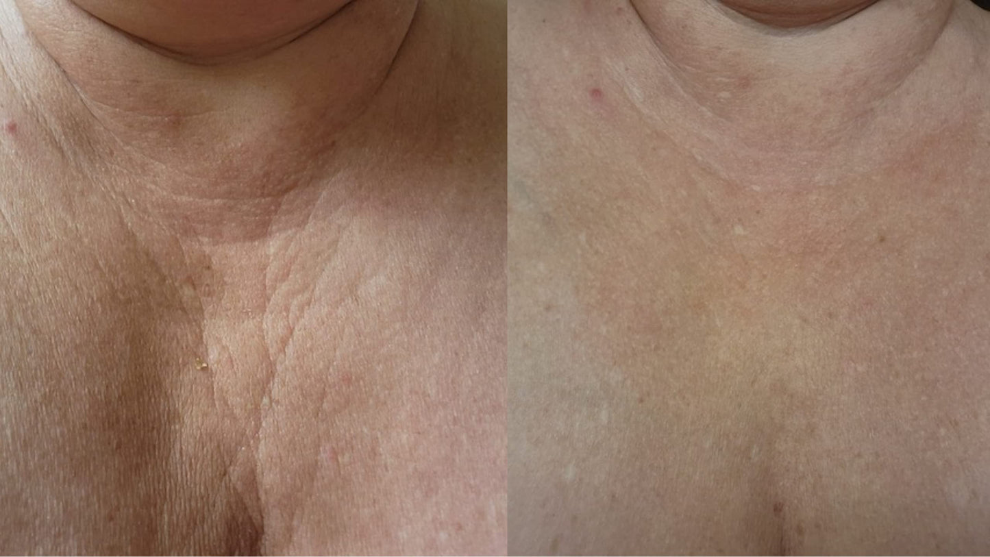 Hyaluronic Rejuvenating Serum for Face & Body 3.34 oz, Natural, Non-greasy, with Vitamin B5 and Niacinamide