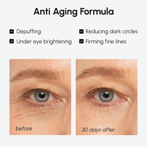 MAREE Under Eye Balm Stick - Hydrating Retinol & Caffeine Brightener for Dark Circles & Wrinkles